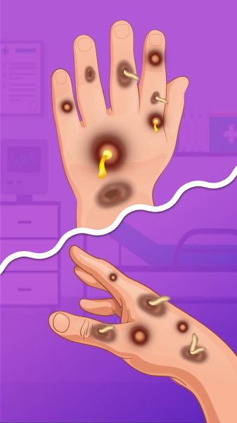 ASMR Doctor Salon Pop Pimples apk Download