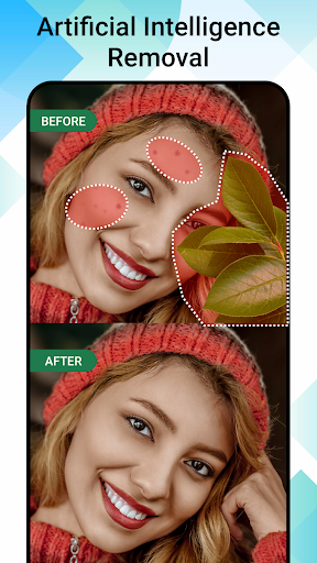 Remove Watermark Easy Retouch mod apk premium unlockedͼƬ1