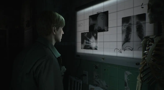 Silent Hill 2 Remake Full Game Free Download v1.0 screenshot 2